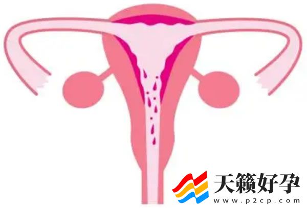 子宫偏小是什么原因造成的(图1)